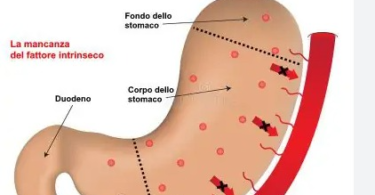 Anemia Perniciosa Sintomi